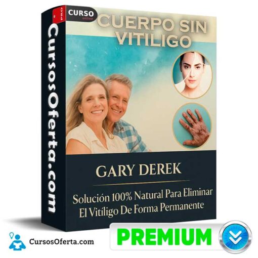 Cuerpo sin vitiligo de Gary Derek 1 Cuerpo sin vitiligo de Gary Derek