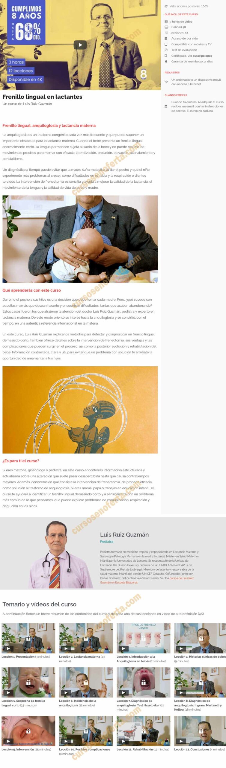 Frenillo lingual en lactantes – Luis Ruiz 2 Frenillo lingual en lactantes - luis ruiz