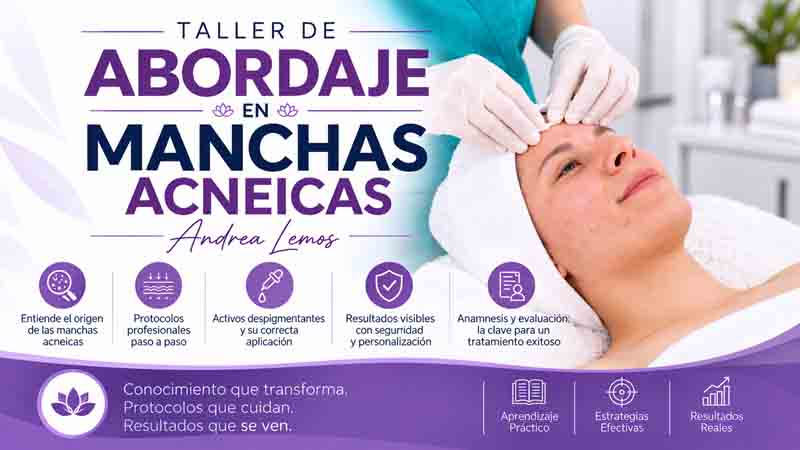 Taller de Abordaje en Manchas Acneicas – Andrea Lemos 1 Taller de Abordaje en Manchas Acneicas – Andrea Lemos